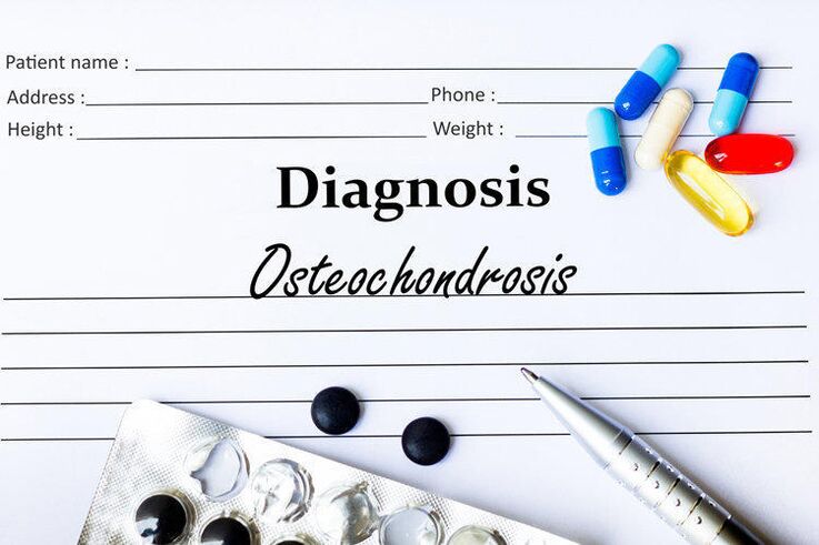 medicamentos para diagnosticar osteocondrose