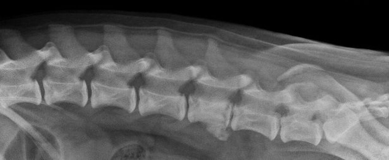 Manifestacións da osteocondrose da columna vertebral torácica nunha radiografía