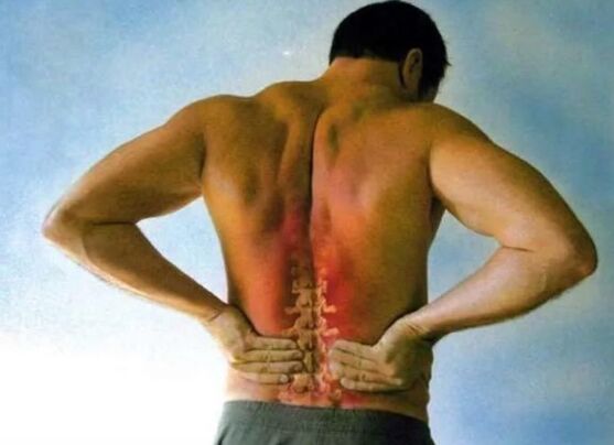 Dor pola osteocondrose lumbar